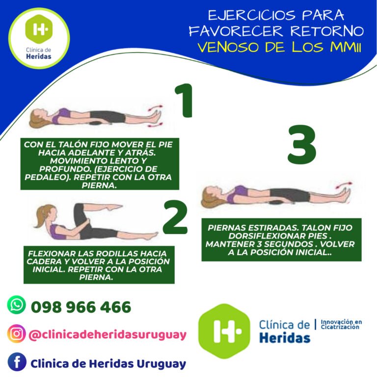 Prevención De Las Ulceras Venosas Clínica De Heridas Uruguay 0914