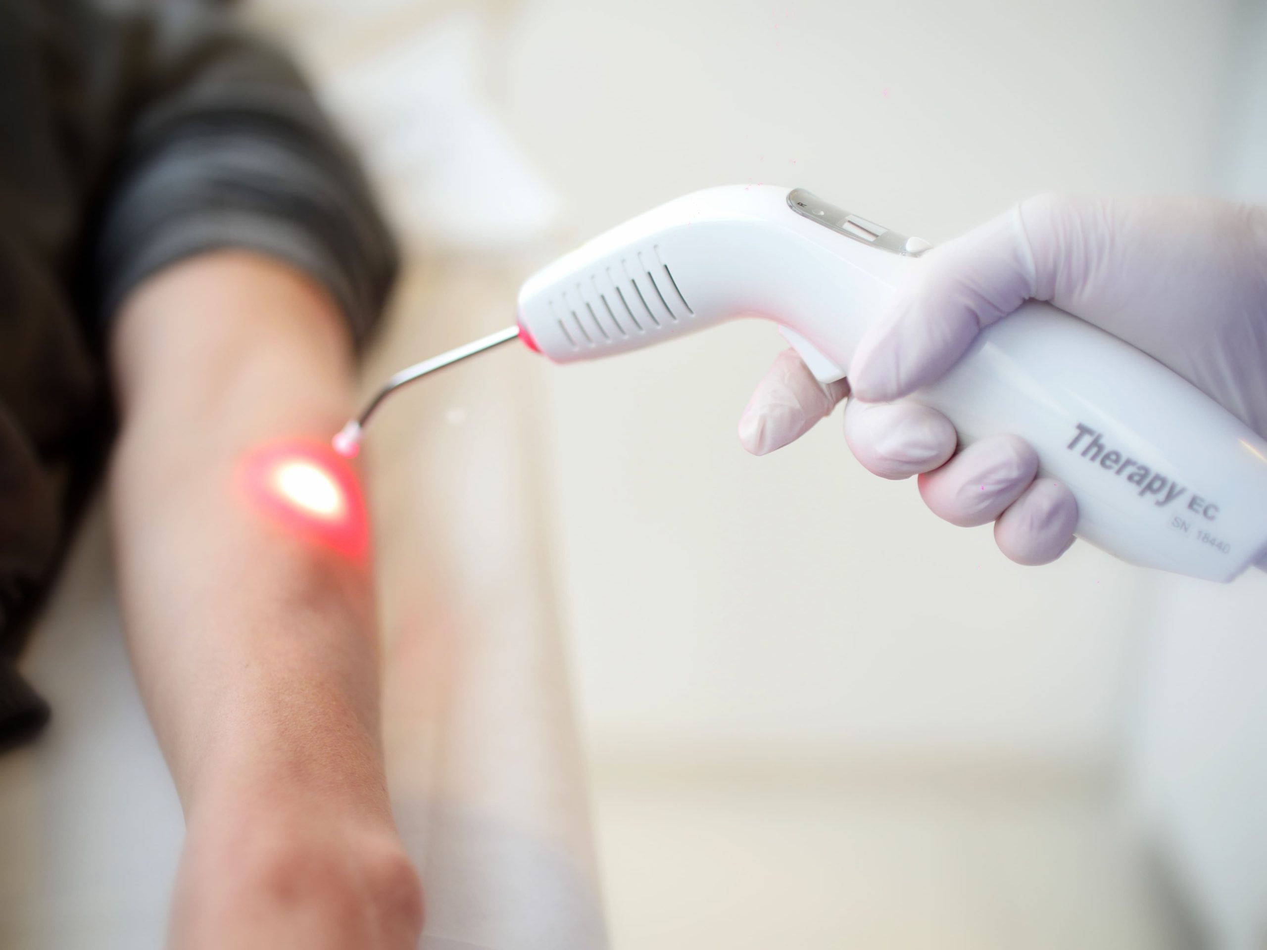 Terapia con Láser de Baja Intensidad